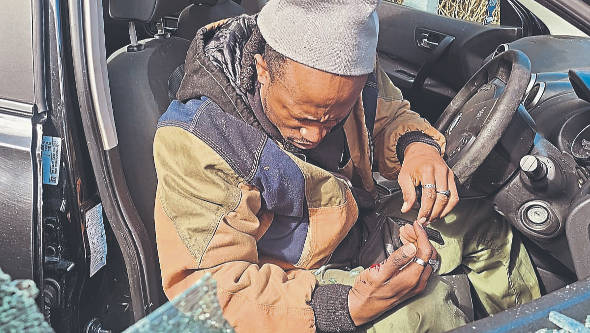 Tobi Omoteso says he is now facing a long, agonising road of surgeries just to cling to a fraction of the vision he once took for granted