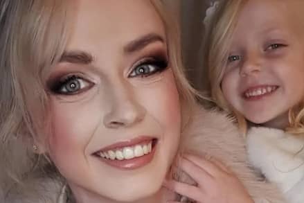 Carolann now worries for her daughter (5) following her own ordeal waiting for scoliosis treatment