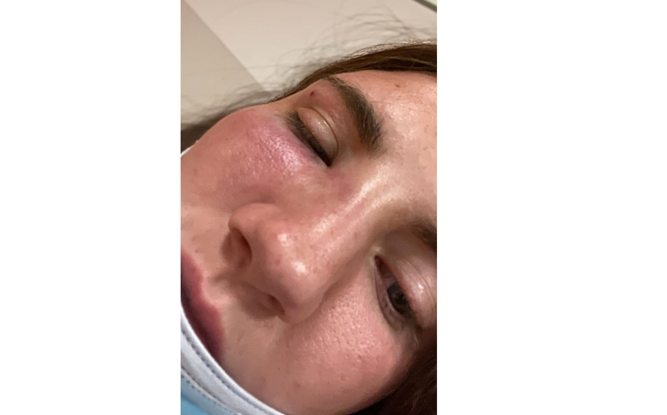 Natasha O’Brien, 24, sustained a broken nose, concussion, swelling and bruising during the attack on O’Connell Street, Limerick on May 29, 2022