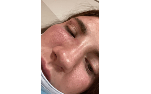 Natasha O’Brien, 24, sustained a broken nose, concussion, swelling and bruising during the attack on O’Connell Street, Limerick on May 29, 2022