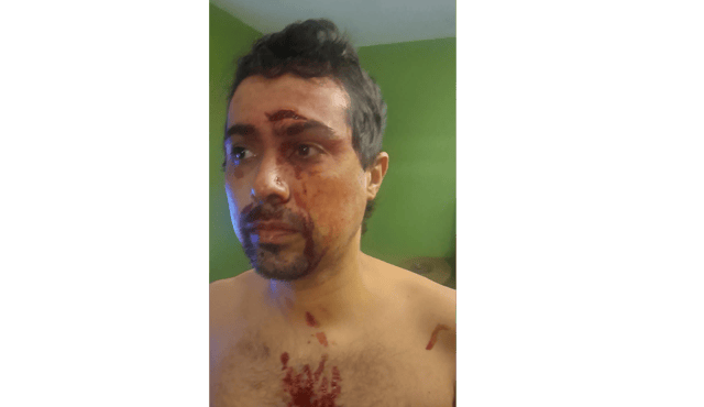 Roberto Junior Leonardo Goncalves after the assault