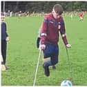 Michael Dennedy, 14, lost his leg but has not let it define him