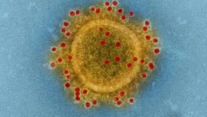 Latest daily increase in Covid-19 cases revealed by the Department of Health