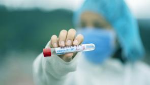 Latest Covid figures released by the Department of Health