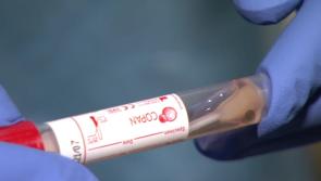 Number of Covid-19 patients  in intensive care has dropped slightly