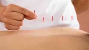 Getting to the point at Cherryblossom Acupuncture 