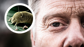 'I can't take any more' - Warning over tiny insects that live on your face