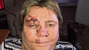 Woman was ‘flung’ out of wheelchair in collision with car outside Limerick hospital