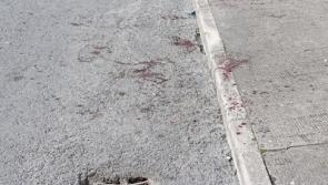 Limerick hatchet victim's family plea for no revenge