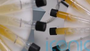 British athlete reportedly under investigation in doping case against Eric Lira