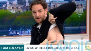 I call it my new little superpower – Tom Lockyer shows defibrillator scar