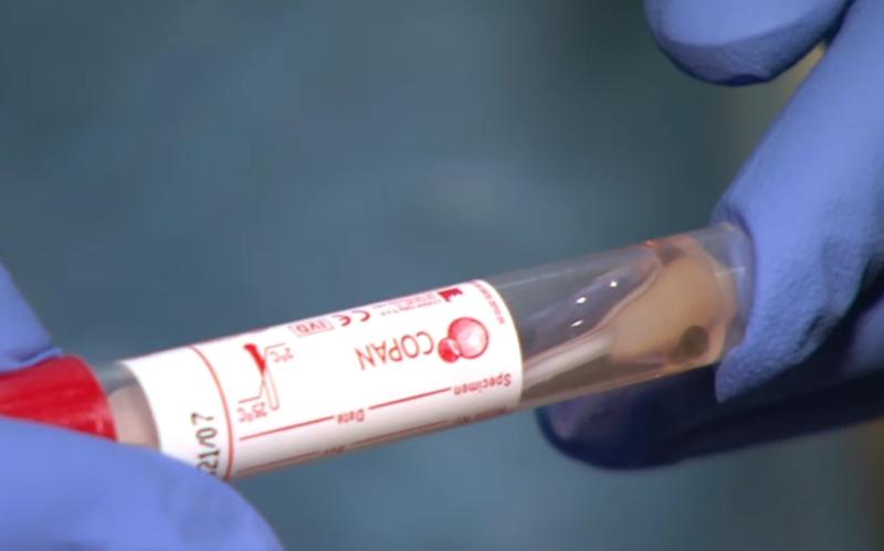 Concern grows as Louth Covid-19 incidence rate rises