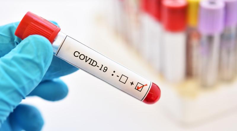 Over 50% Covid positivity rate recorded this week, latest data reveals