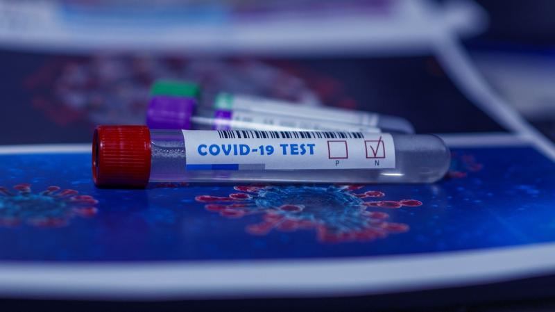 BREAKING: Record number of new cases of Covid-19 reported this Christmas Eve