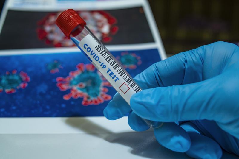 BREAKING: Another sharp spike in Covid cases 