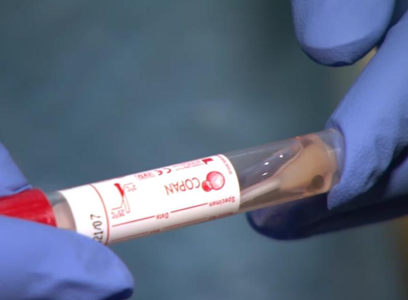 Researcher outlines why some people don't catch Covid despite partner having virus