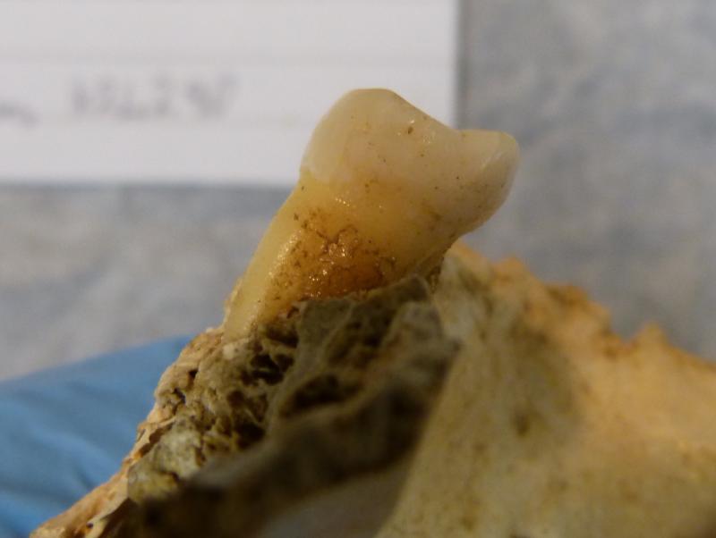 Brushing up on the Bronze Age: 4,000-year-old tooth found in Limerick