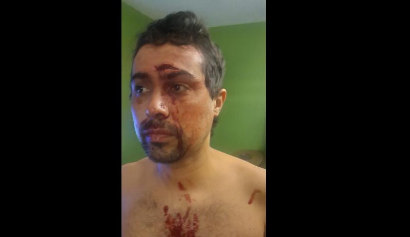 Brazilian assault victim is now afraid of living in Limerick