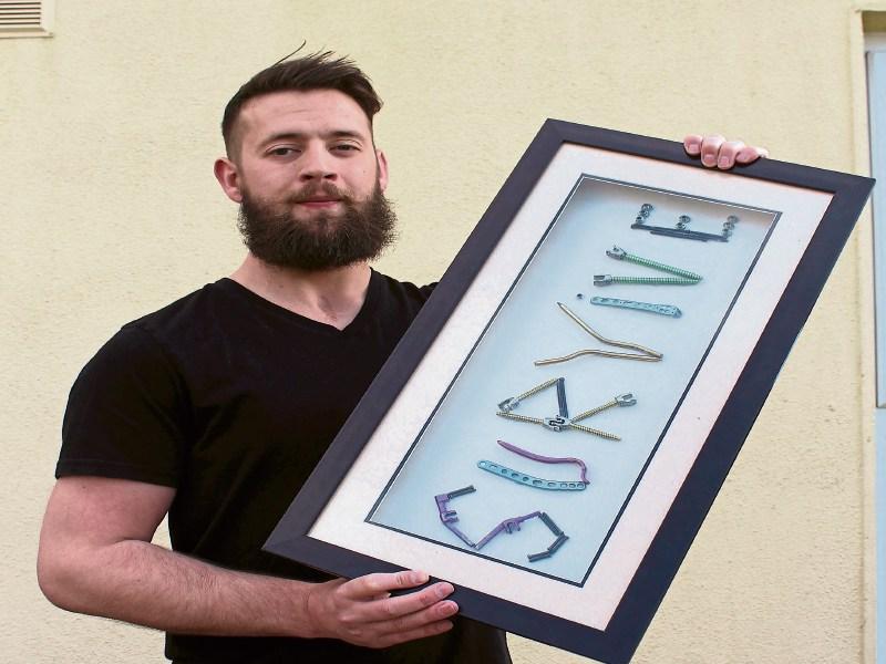 Survive: Limerick man's inspirational recovery from 60 foot fall