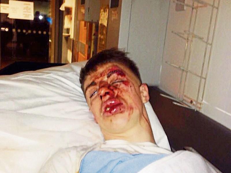 Student, 19, in 'unprovoked' attack in first visit to Limerick