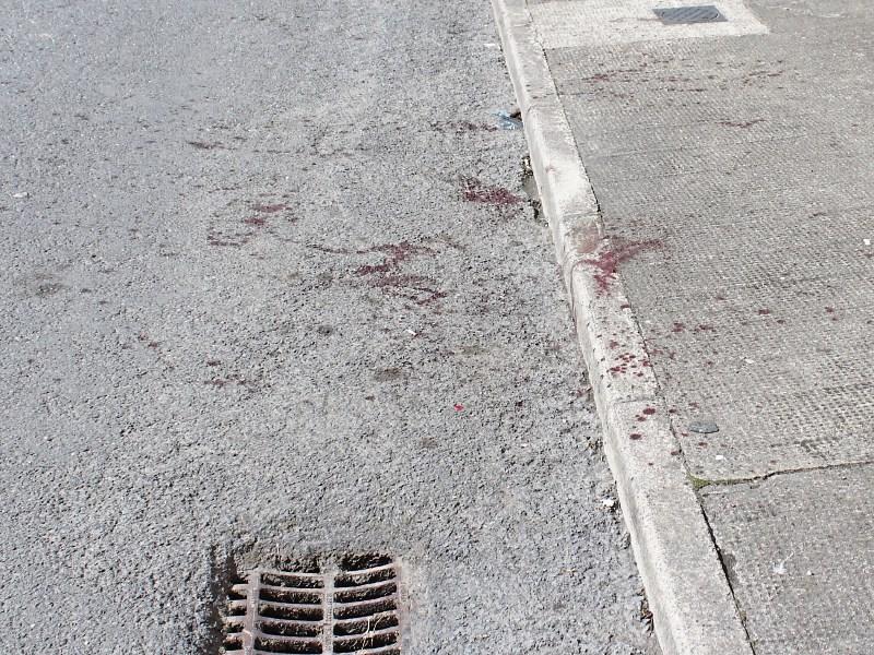 Limerick hatchet victim's family plea for no revenge