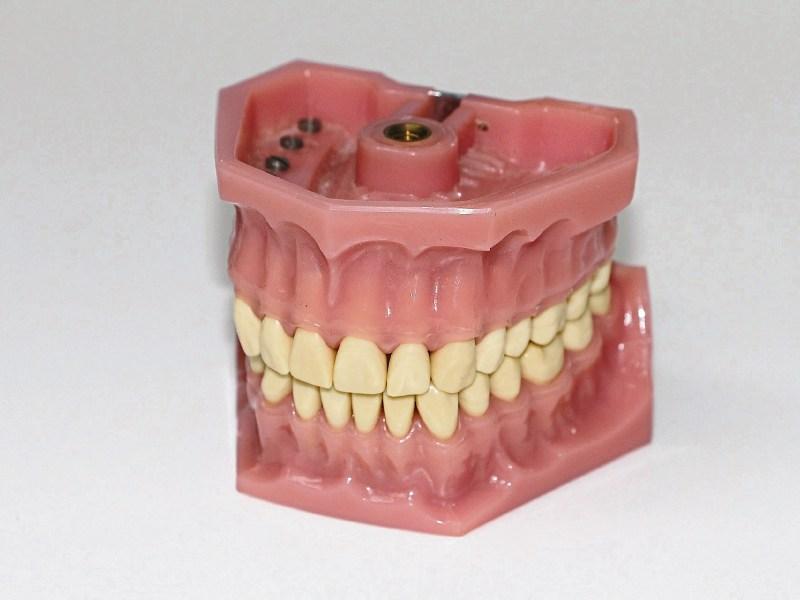 John B Keane: Chew then chuck - dentures can now be disposable
