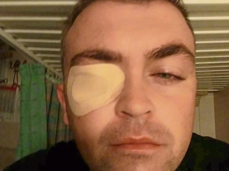 Limerick fire breather admitted to A&E in Bahamas after burning eyes with chili crisp fingers