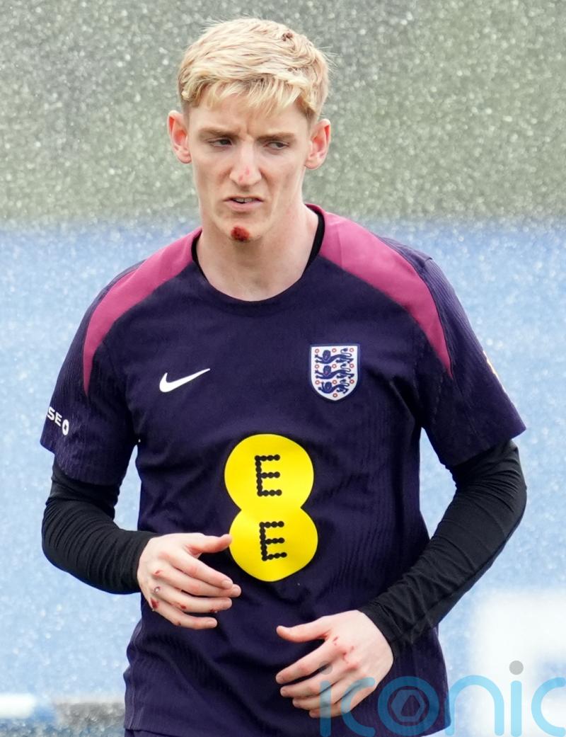 Chin up Anthony! Gordon the butt of jokes in England camp after bike fall