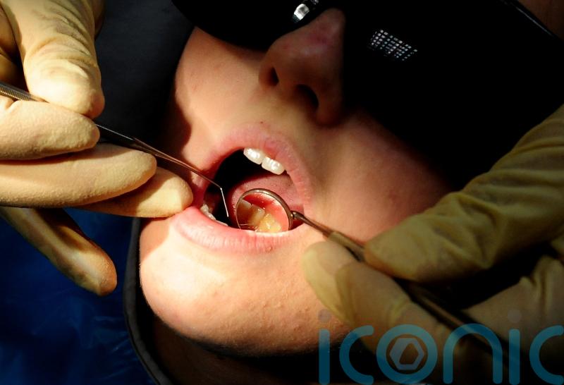 Ban on amalgam fillings in Northern Ireland avoided after EU agrees derogation